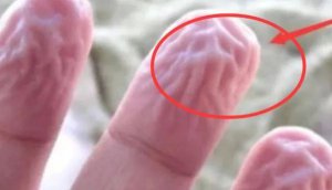 Ϊʲôϴ������ָ�����_��ָ�ͽ�ֺ����������ô���£�