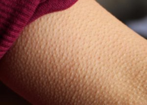 ��Ϊʲô����Ƥ����_��Ƥ������ʲôԭ��