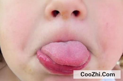 ���̷��ϻ��֢״����Щ