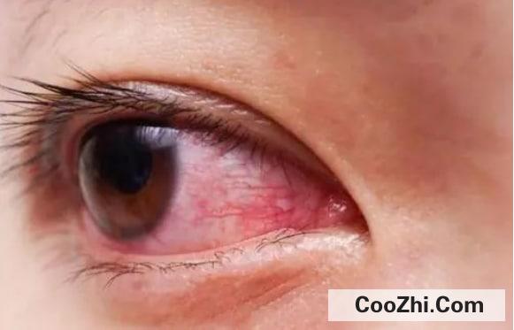 �����۾�����������ô��