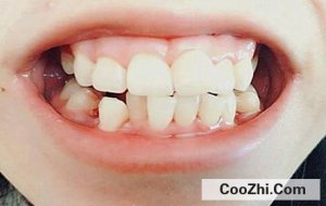 ���ݲ���������ô����