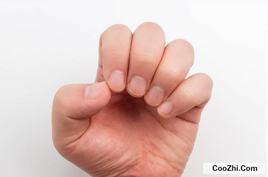 ��ָ�׵�����С����ʲô