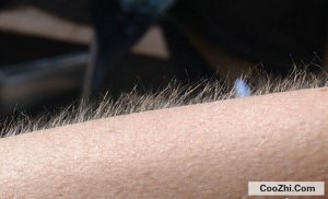 ��ë�Ķ��ٸ��Ŵ��й�ϵ��