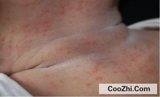 �ղر�����ճ���������Щ